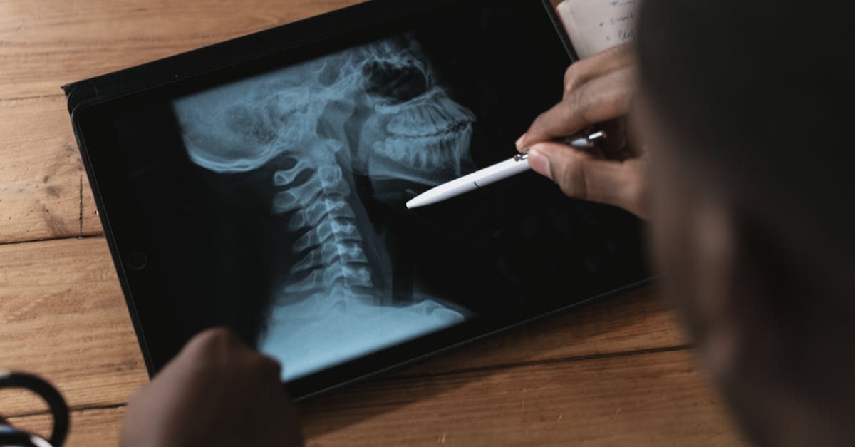découvrez tout sur la radiculopathie cervicale : causes, symptômes, traitements et conseils pour soulager la douleur. informez-vous afin d'améliorer votre qualité de vie.