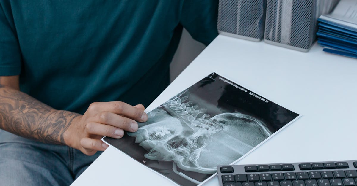 découvrez tout ce qu'il faut savoir sur les spasmes cervicaux : causes, symptômes, traitements et conseils pour soulager votre douleur au cou. informez-vous pour mieux gérer cette condition et améliorer votre qualité de vie.