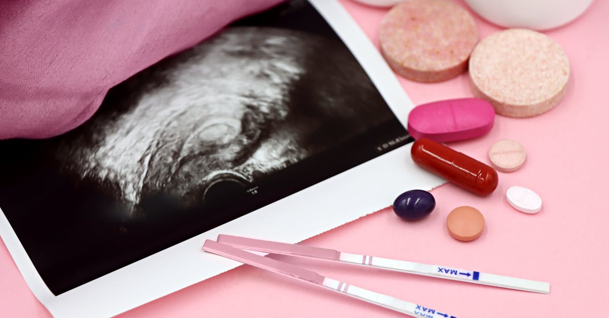 découvrez les causes et les solutions aux maux de tête hormonaux. apprenez à identifier les déclencheurs liés aux fluctuations hormonales et explorez des conseils pour soulager ces douleurs. retrouvez votre bien-être grâce à des stratégies adaptées.