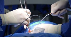 découvrez tout sur la sténose spinale : causes, symptômes, options de traitement et conseils pour vivre avec cette condition. informez-vous sur les meilleures pratiques pour soulager la douleur et améliorer votre qualité de vie.