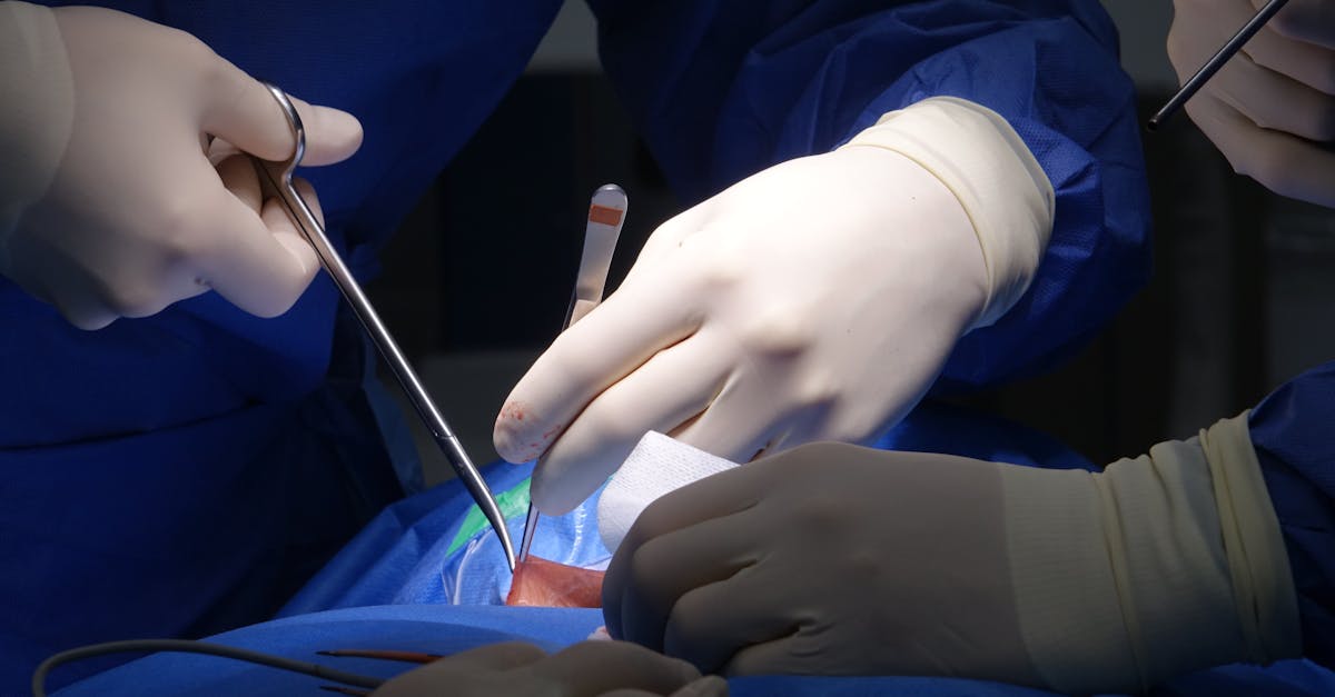 découvrez tout sur le disque hernié, ses symptômes, causes et traitements. informez-vous sur les meilleures méthodes de prévention et de soulagement pour une vie sans douleur.
