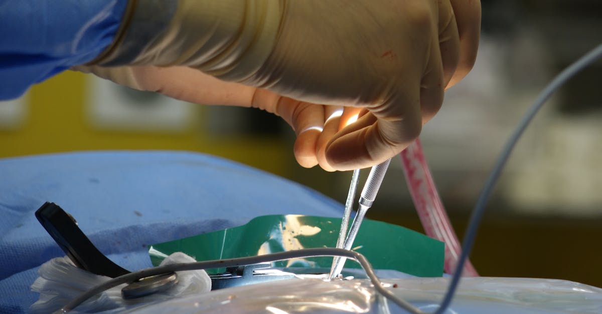 découvrez tout sur la sténose spinale, une condition qui provoque un rétrécissement du canal spinal. apprenez-en davantage sur ses causes, symptômes, traitements et conseils pour soulager la douleur et améliorer votre qualité de vie.
