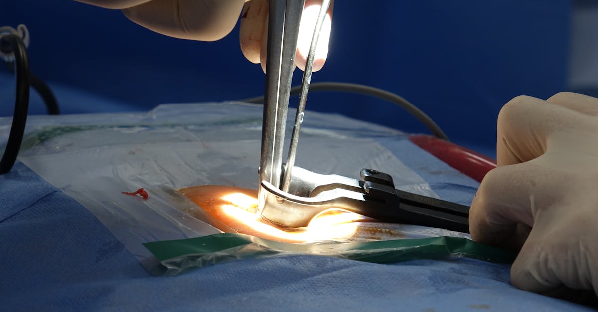découvrez tout ce que vous devez savoir sur la hernie discale : symptômes, causes, traitements et conseils pour soulager la douleur. informez-vous pour mieux comprendre cette condition courante et améliorer votre qualité de vie.